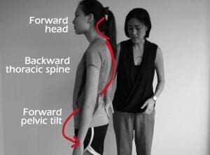 swayback posture back pain posture