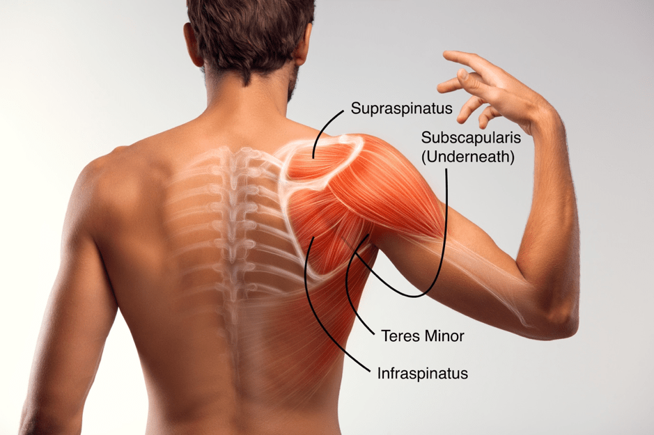 rotator cuff tear