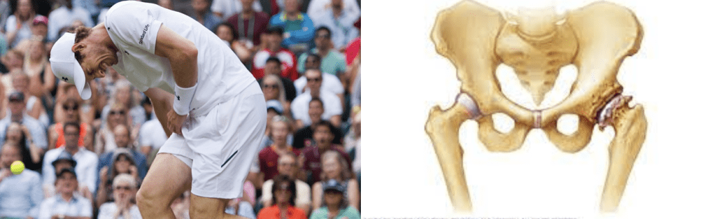 andy murray wimbledon injuries