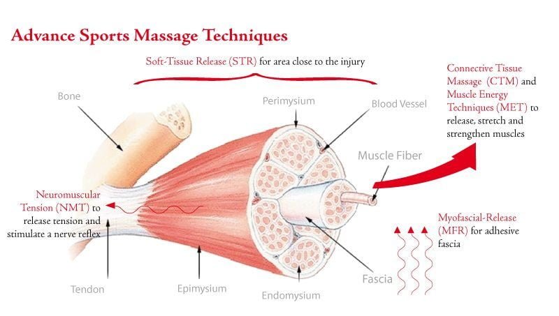 Advance Sports Massage Techniques